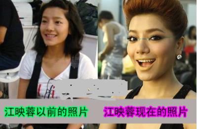 江映蓉整容前后照片:江映蓉和郁可唯分手