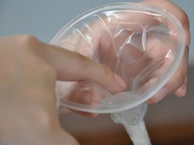 避孕套是最常见和最安全的,可以防止性传播疾病的传播.