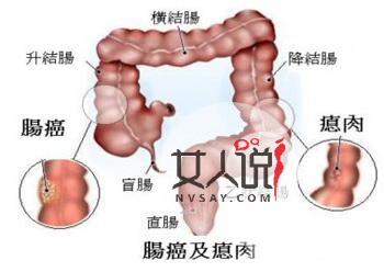 主页 女性养生保健 养生保健 > 正文  因为大便出血是直肠癌的症状