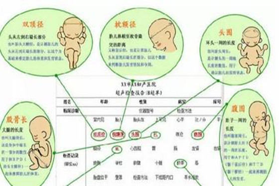 双顶径是指哪里图片