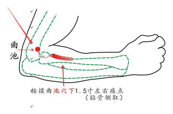 發燒搓哪個部位退燒快的5個穴位圖 成人兒童都適用