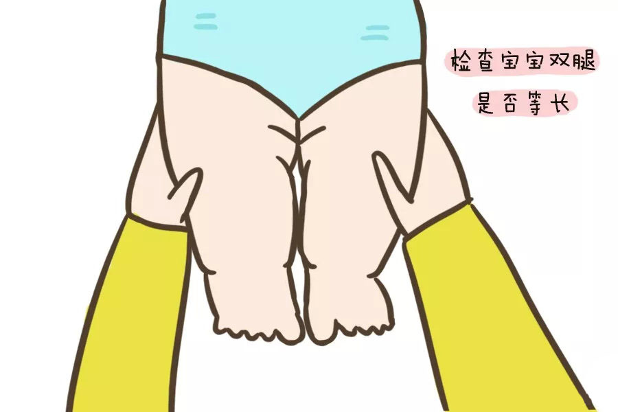 腿纹/臀纹不对称就是髋关节发育有问题?学会自查方法,越早发觉越好